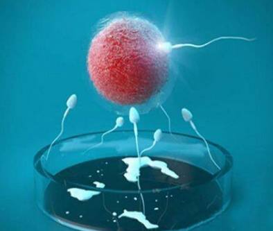 体外受精 IVF-ET